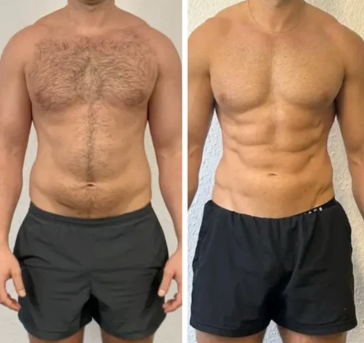 MuscleLabs™ Ab Stimulator – 20,000 Reps in 20 Minutes